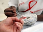 Cum se face testul HIV