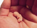 Recuperarea dupa avort