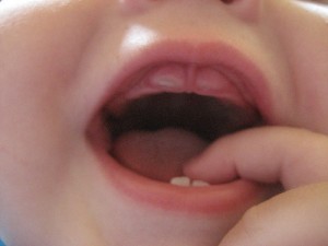 Aparitia dintilor la copii