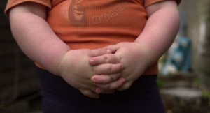 Cauze obezitate la copii